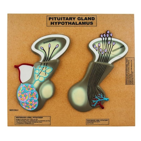 Model Of Pituitary Gland And Hypothalamus, Greatly Enlarged: